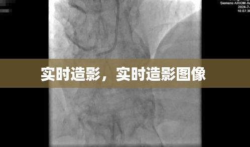 实时造影,实时造影图像