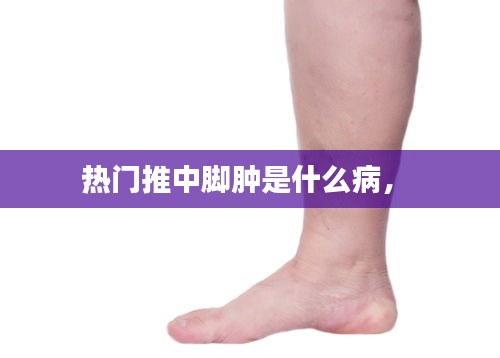 热门推中脚肿是什么病,