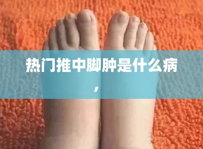 热门推中脚肿是什么病,