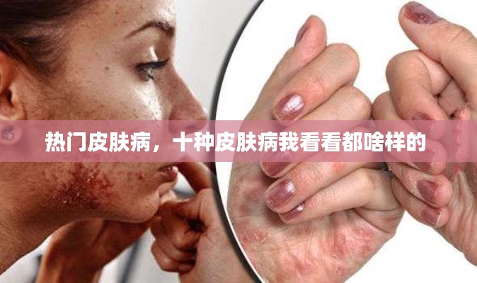 热门皮肤病,十种皮肤病我看看都啥样的