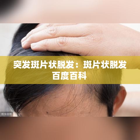 突发斑片状脱发:斑片状脱发百度百科