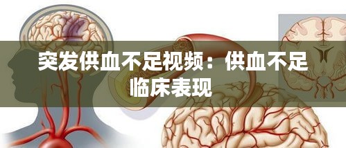 突发供血不足视频:供血不足临床表现