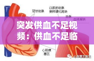 突发供血不足视频:供血不足临床表现