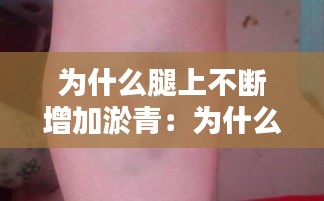 为什么腿上不断增加淤青:为什么腿上一直出现淤青