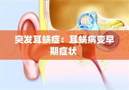 突发耳蜗症:耳蜗病变早期症状